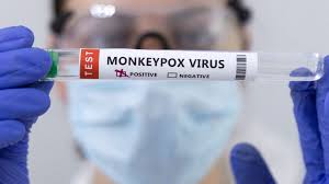 monkey-pox-viurs-and black people